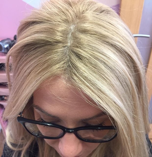 Hair loss consultant in full PPE | Hair to Ware