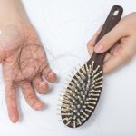 Is my hair loss temporary or permanent