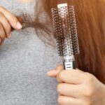 alopecia awareness