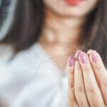 hair loss due to stress