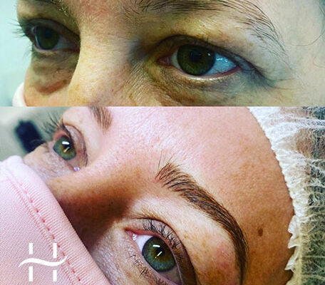 semi-permanent-makeup-alopecia-eyebrows-treatment-hair-loss-salon semi-permanent-makeup-alopecia-eyebrows-treatment-hair-loss-salon