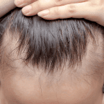 wig wearing for comfort and style