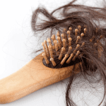 types of hair loss