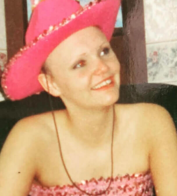 Amanda suffered from Alopecia as a young teen